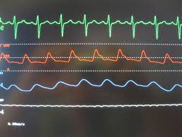 heart rate on paper