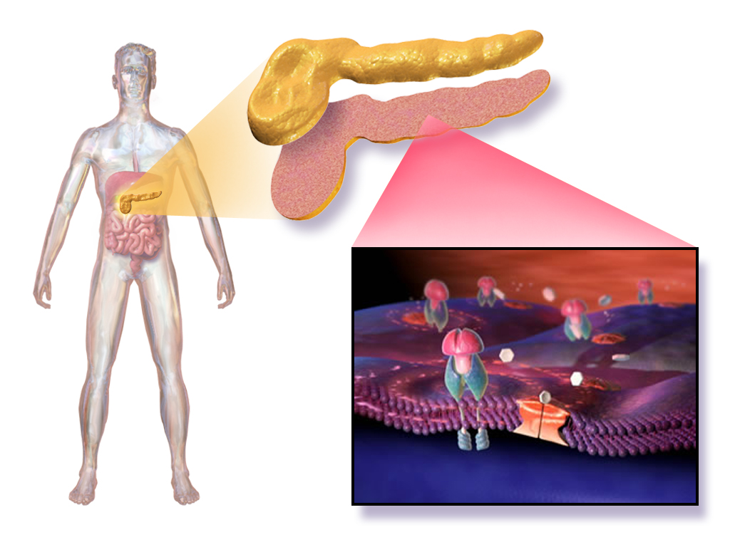 Type 2 diabetes cell 