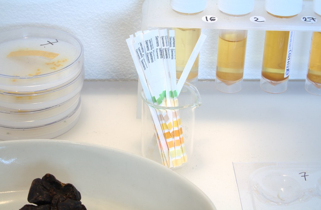 test of urine