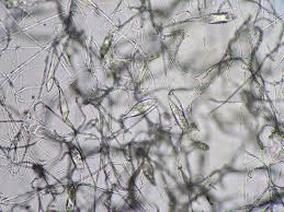 view of Microsporum under the microscope