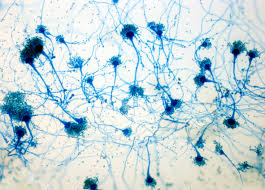 view of Aspergillus under the microscope