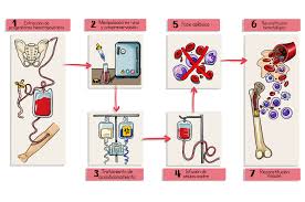 image of stem cell transplants