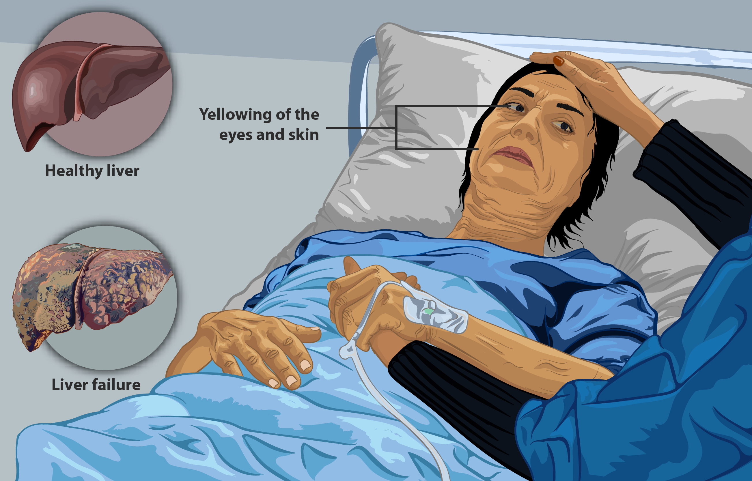person with liver damage or dysfunction