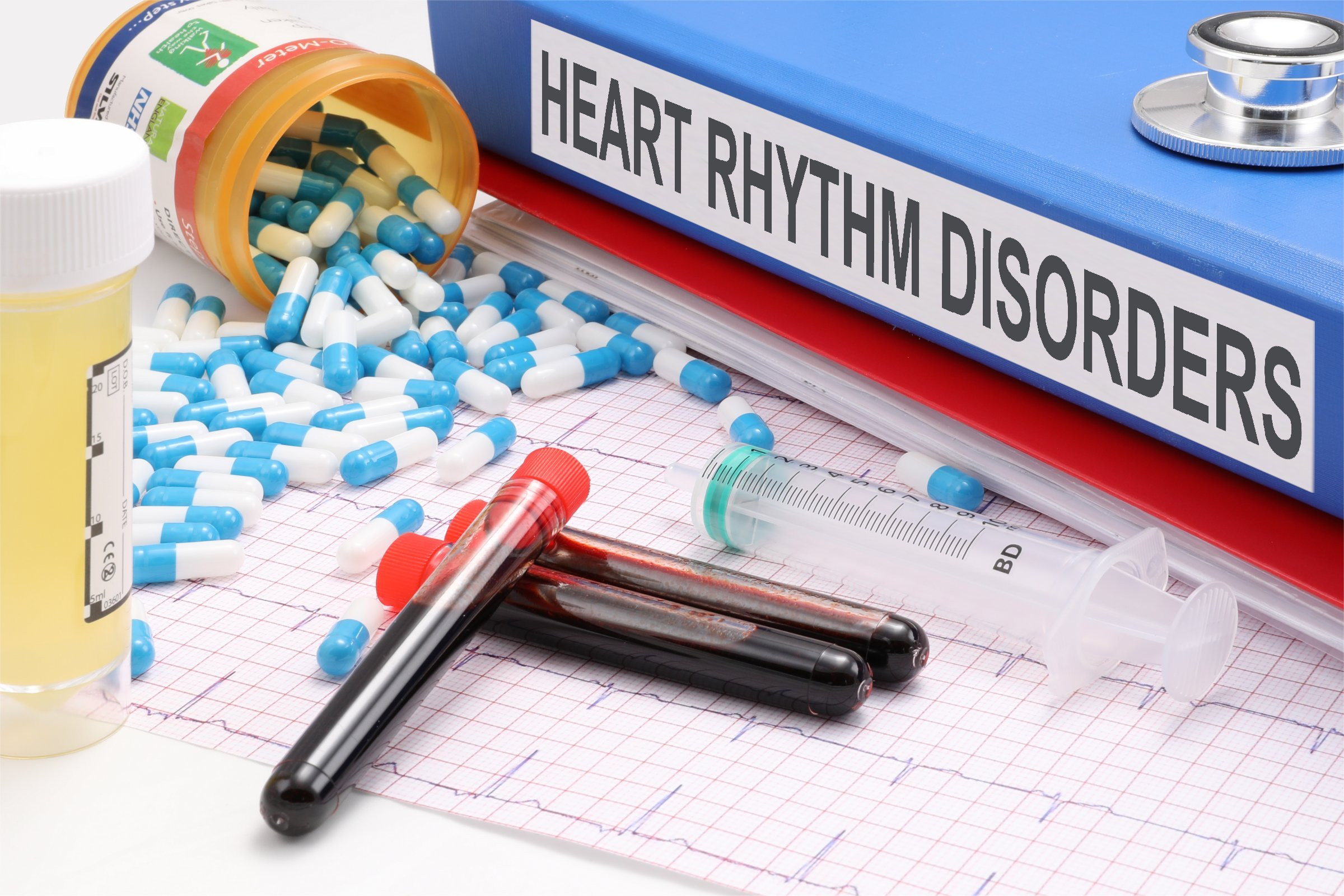 heart rhythm disorder