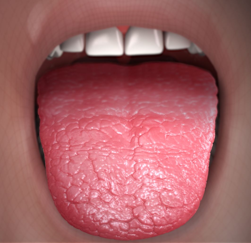 dry cracked mouth