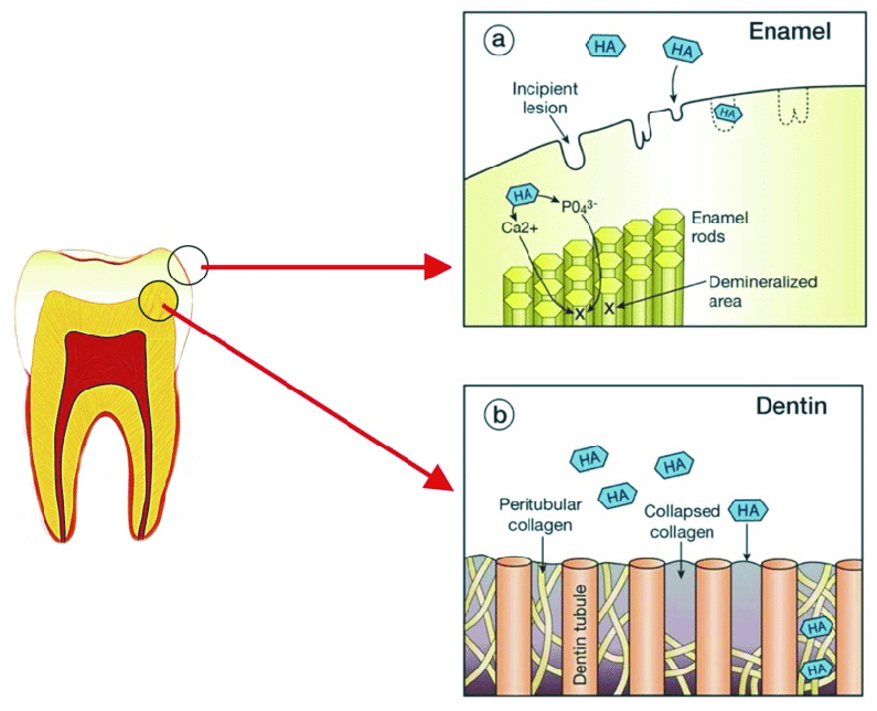dental nerves