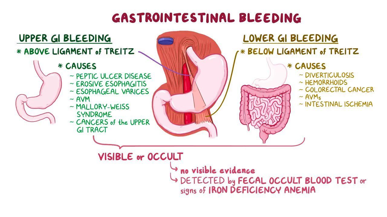 gastrointestinal bleeding 