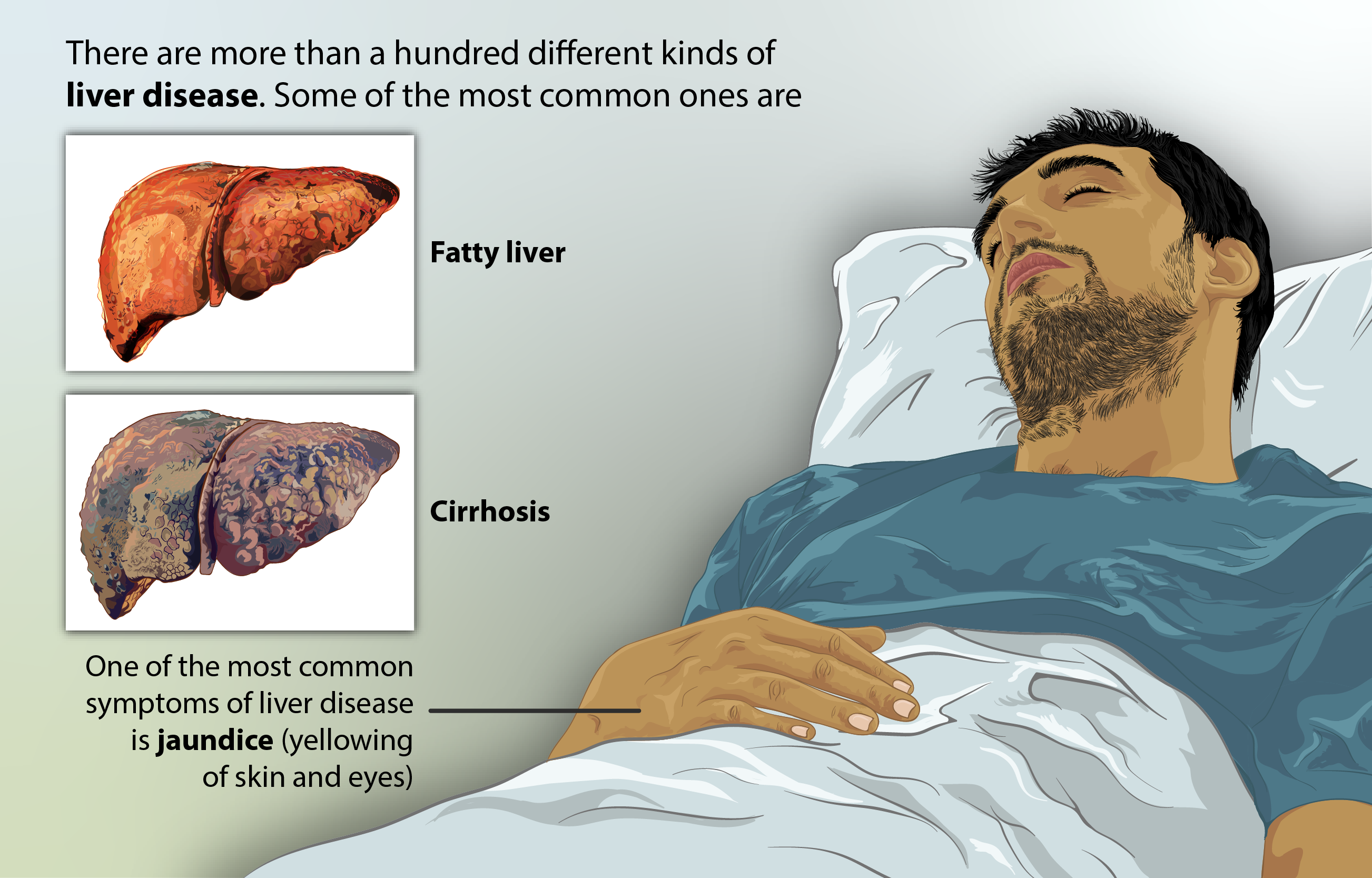person suffering with liver issues yellow skin person laying down on the bed 
