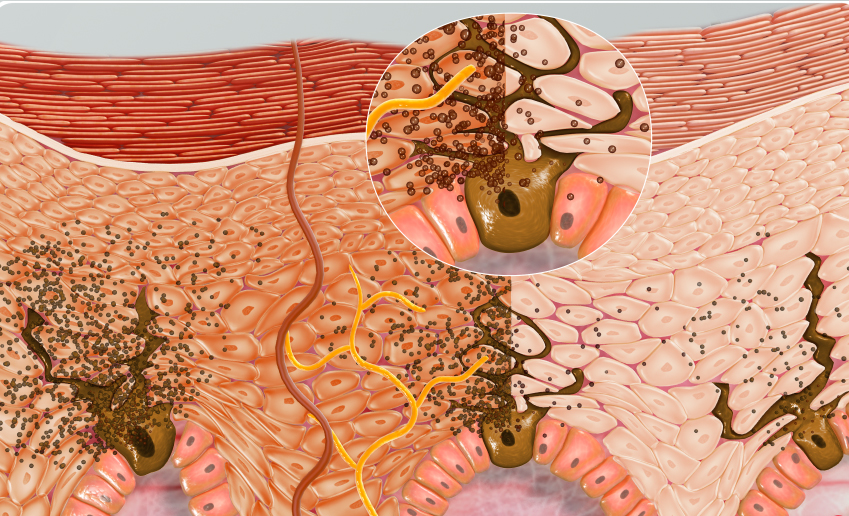 melanin production in skin