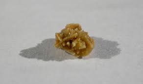 yellow kidney stone