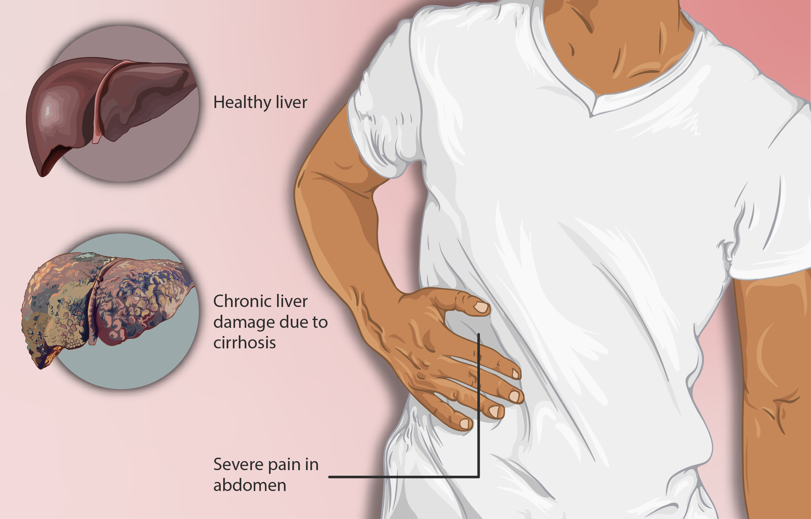 healthy and unhealthy liver