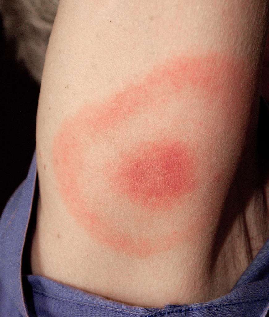red spots around the body