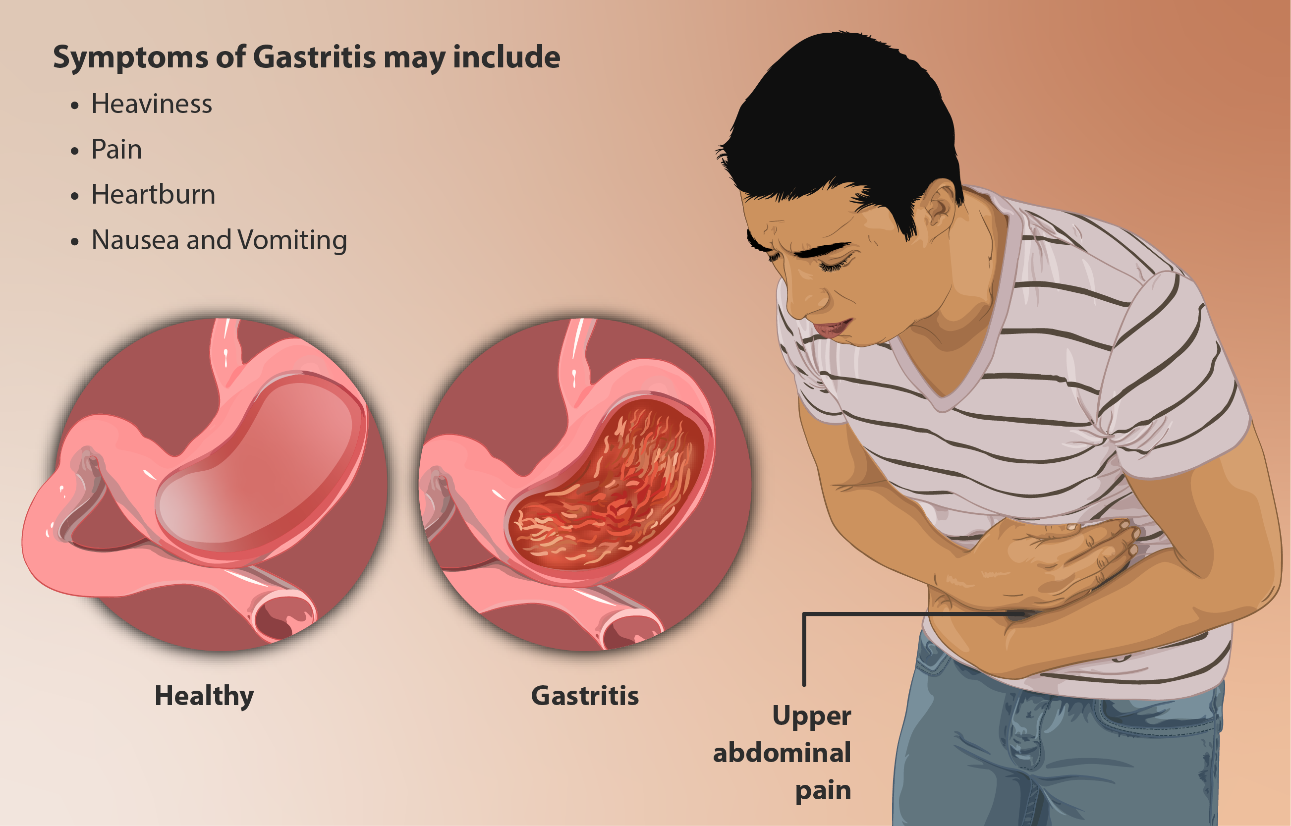 symptoms of gastritis