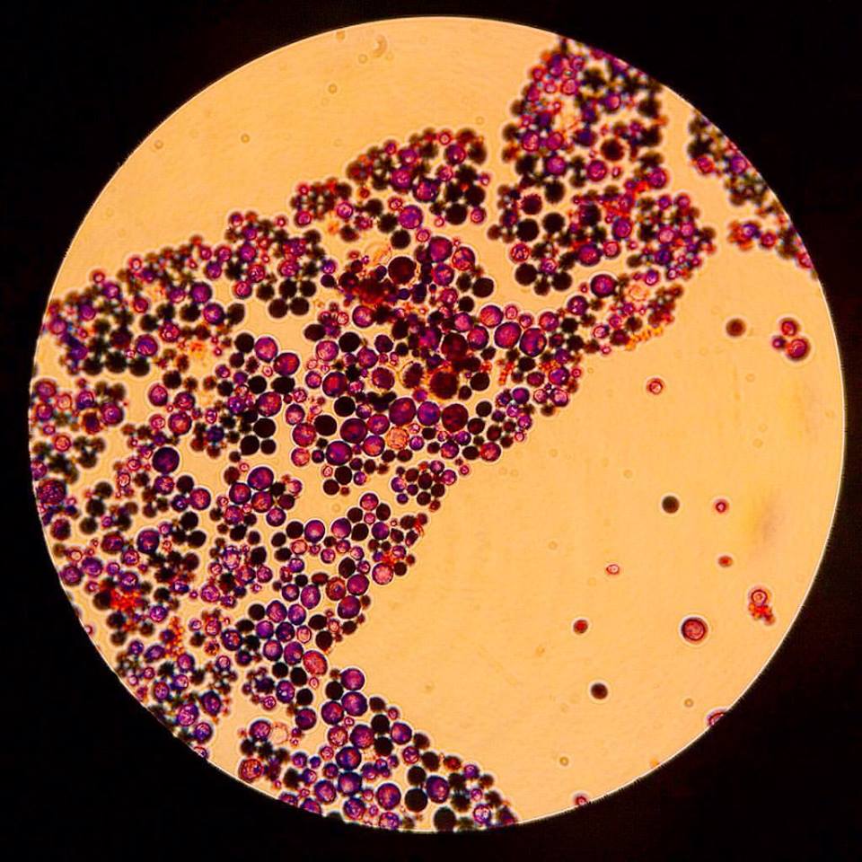 candida albicans view under the microscope cells