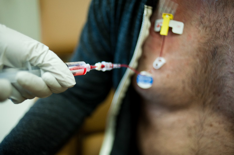 chemotherapy patient undergoing therapy on the chest