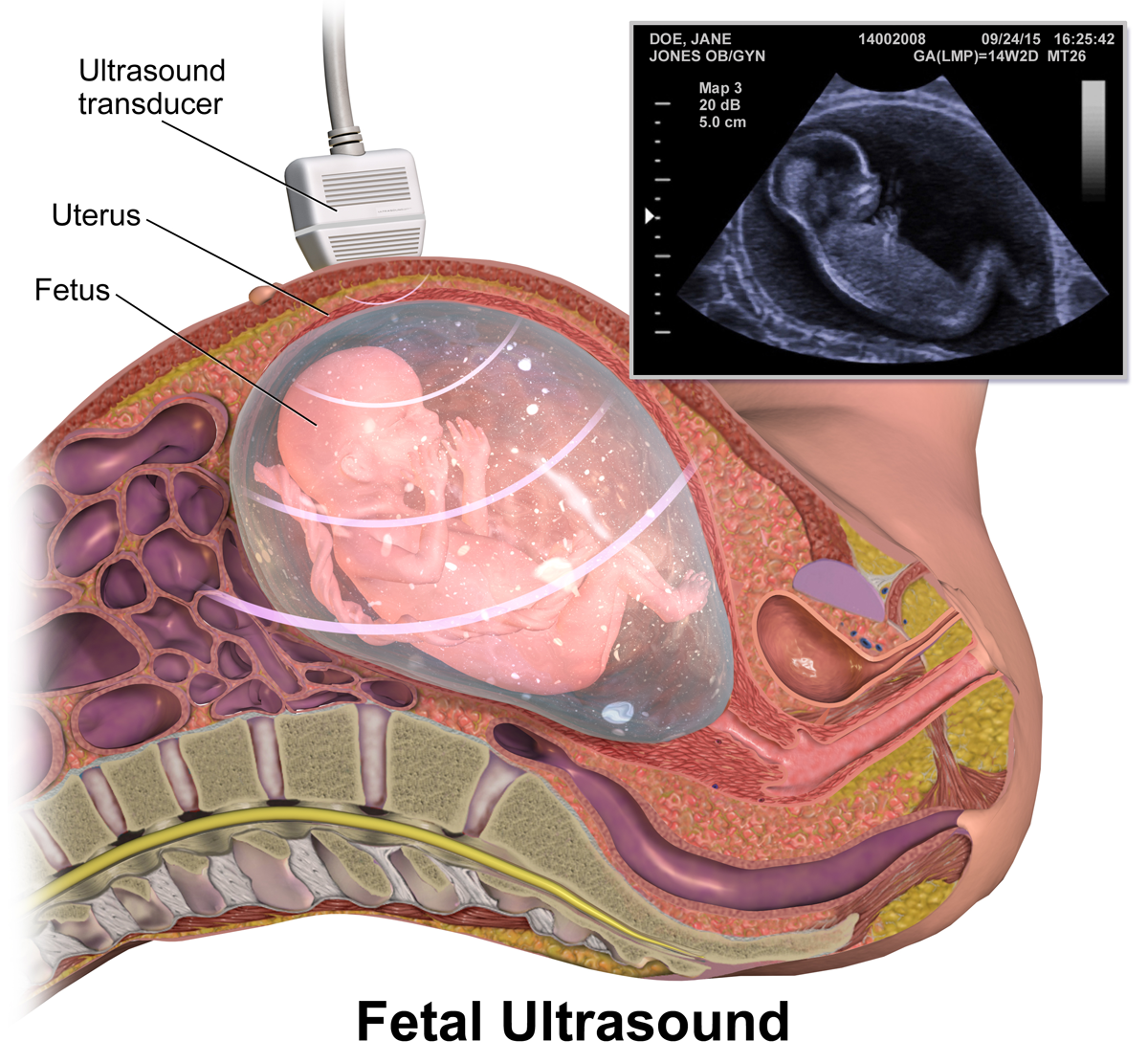 ultrasound of baby