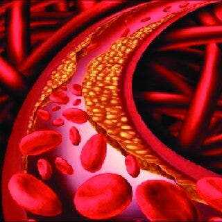 cholesterol in blood stream