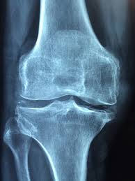 knees joint