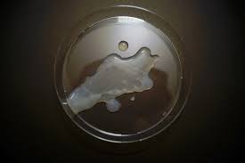 seminal fluid on petri dish