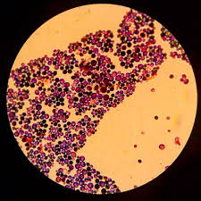 candida albicans under the microscope