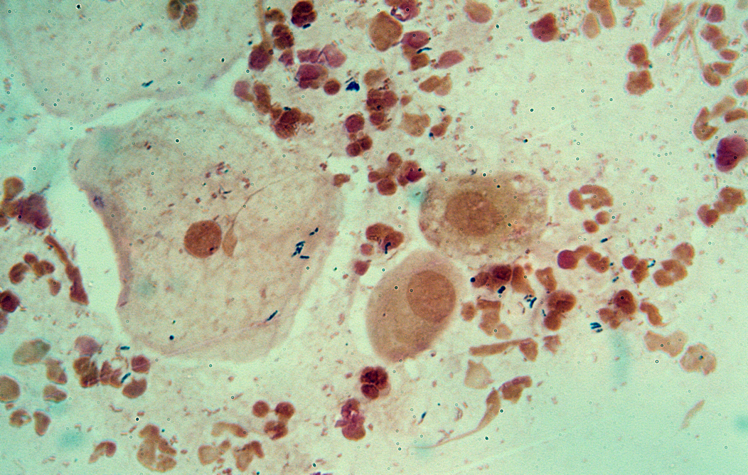 close up of vaginitis bacteria