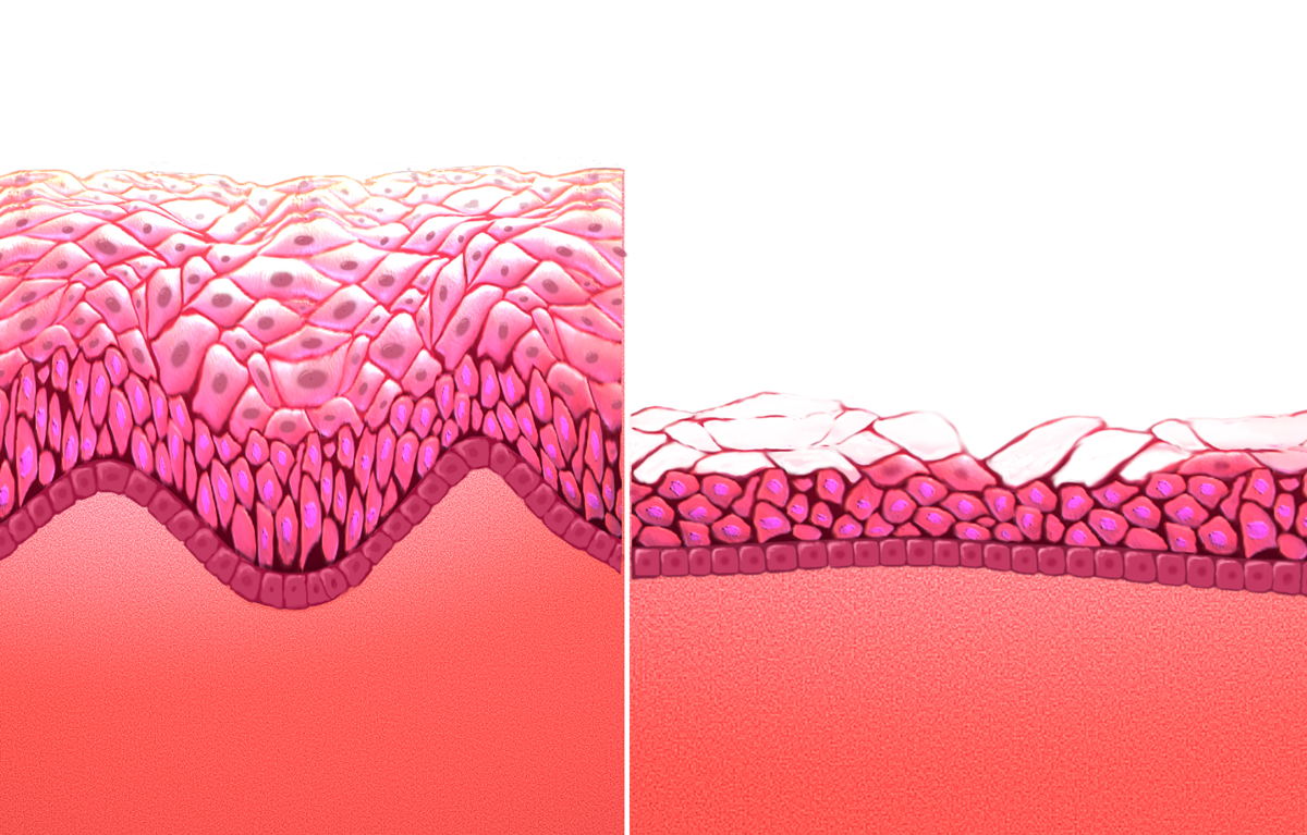 mucosal difference of normal and menopausal women