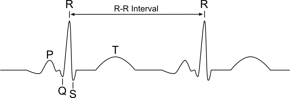 ECG monitoring