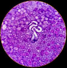 heartworm inside heart of dog