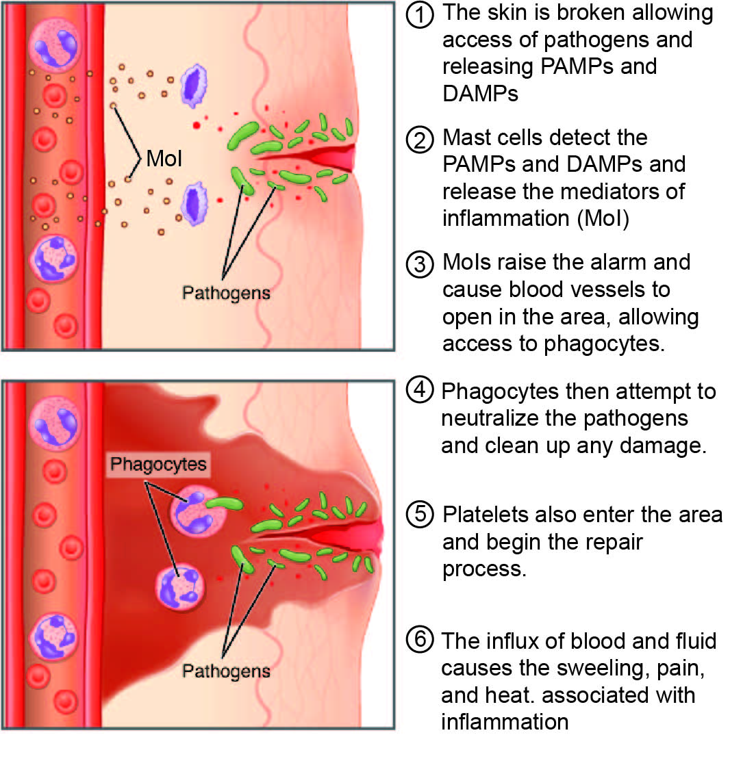 skin inflammation process 
