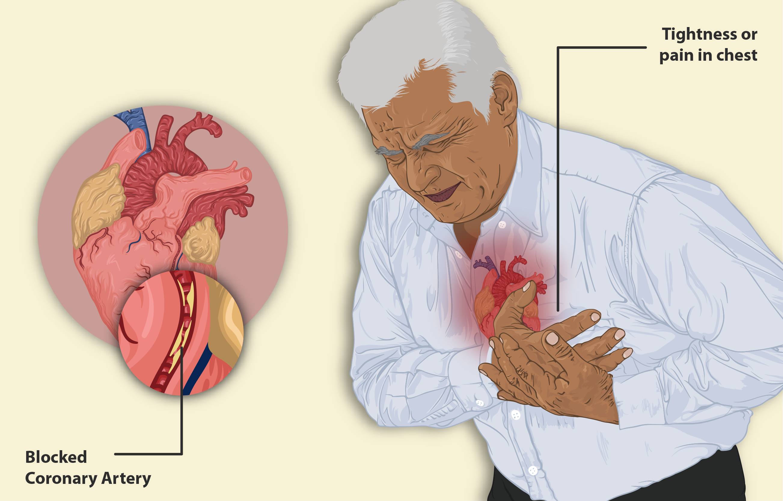 heart failure symptoms