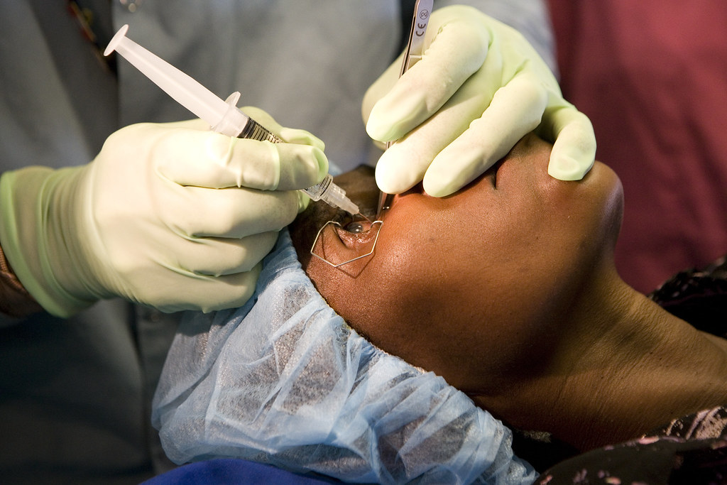 woman getting eye surgery