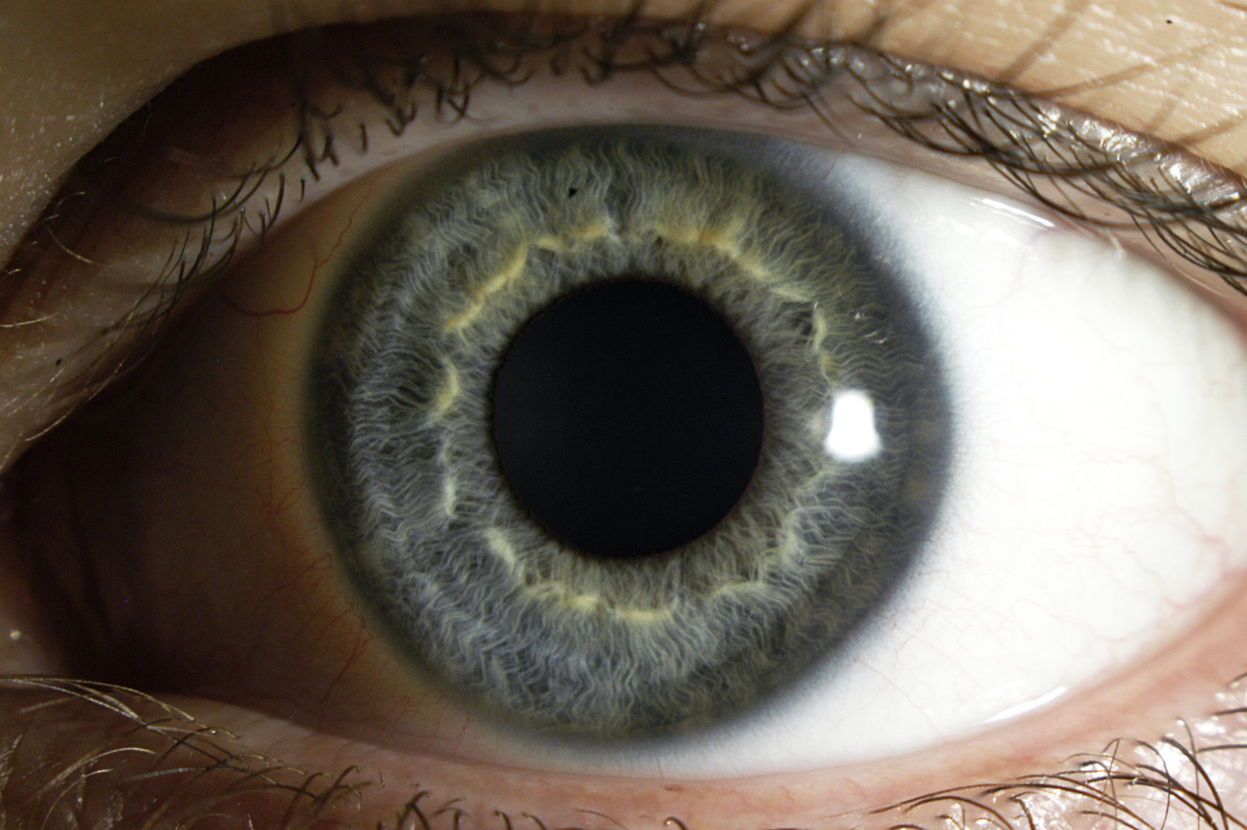 cornea