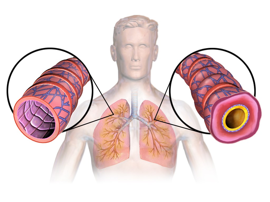 lungs with asthma