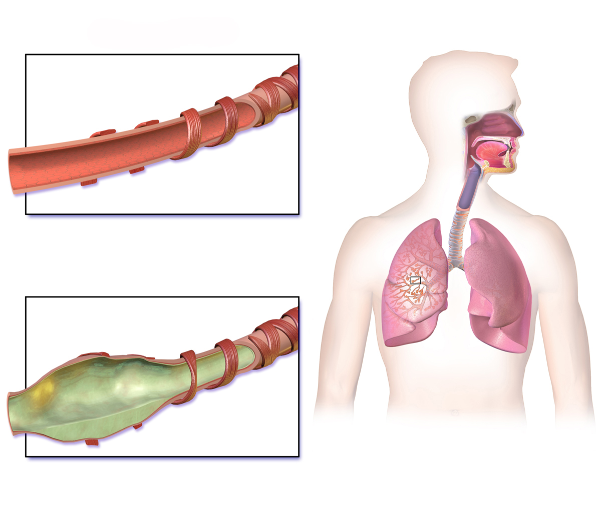 airways in the lungs