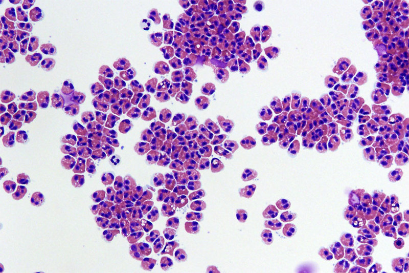 white blood cell proliferation