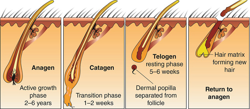 hair loss