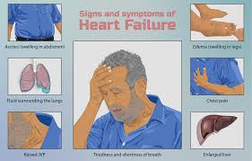 symptoms of heart failure