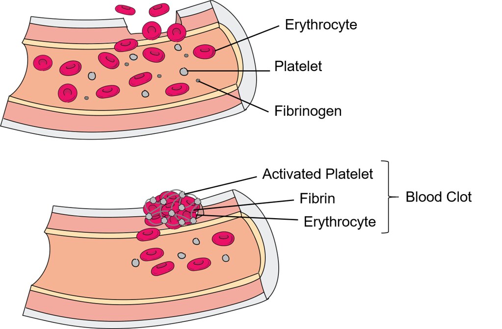 blood clotting in the human vein