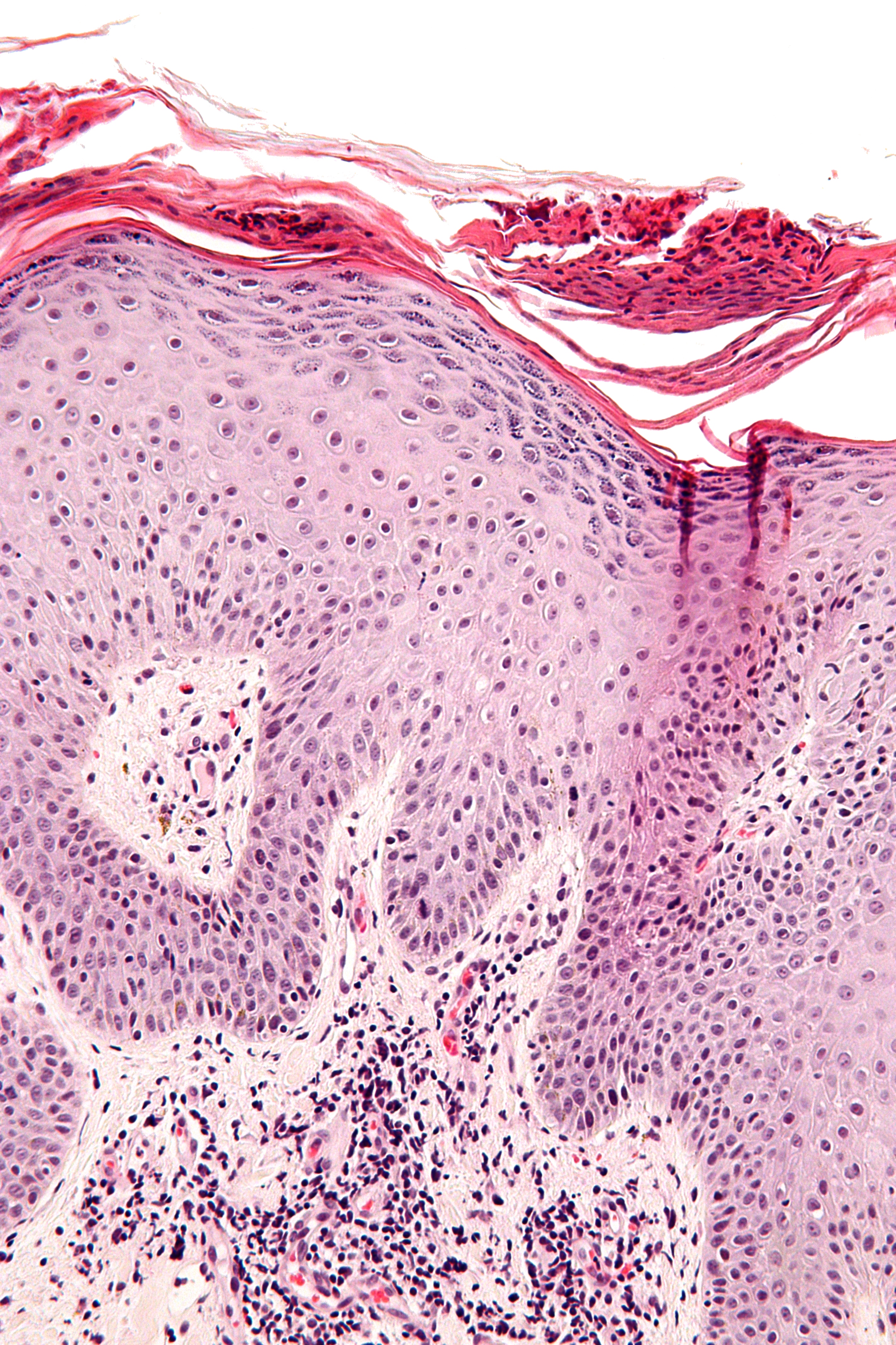 dermatomycoses under the microscope