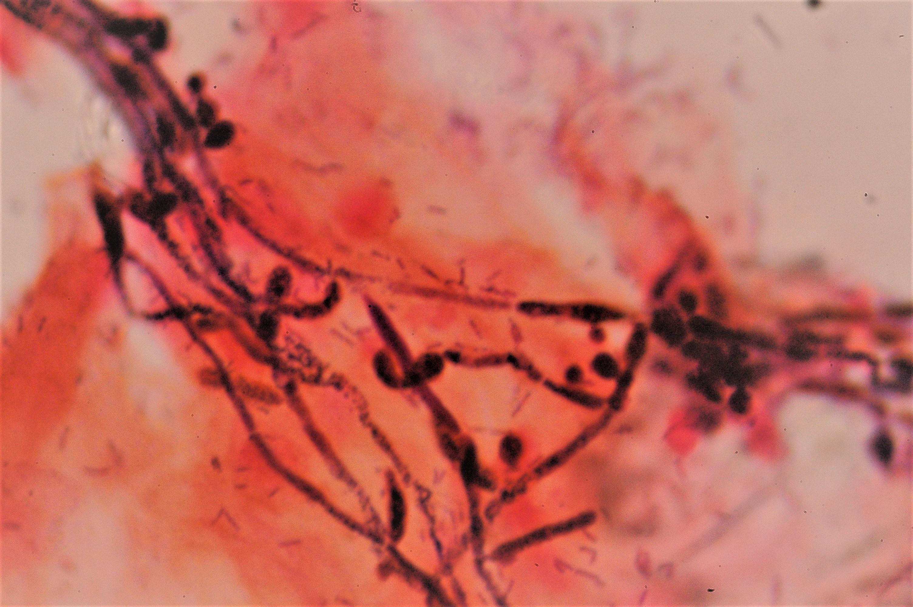 vaginal candida strain