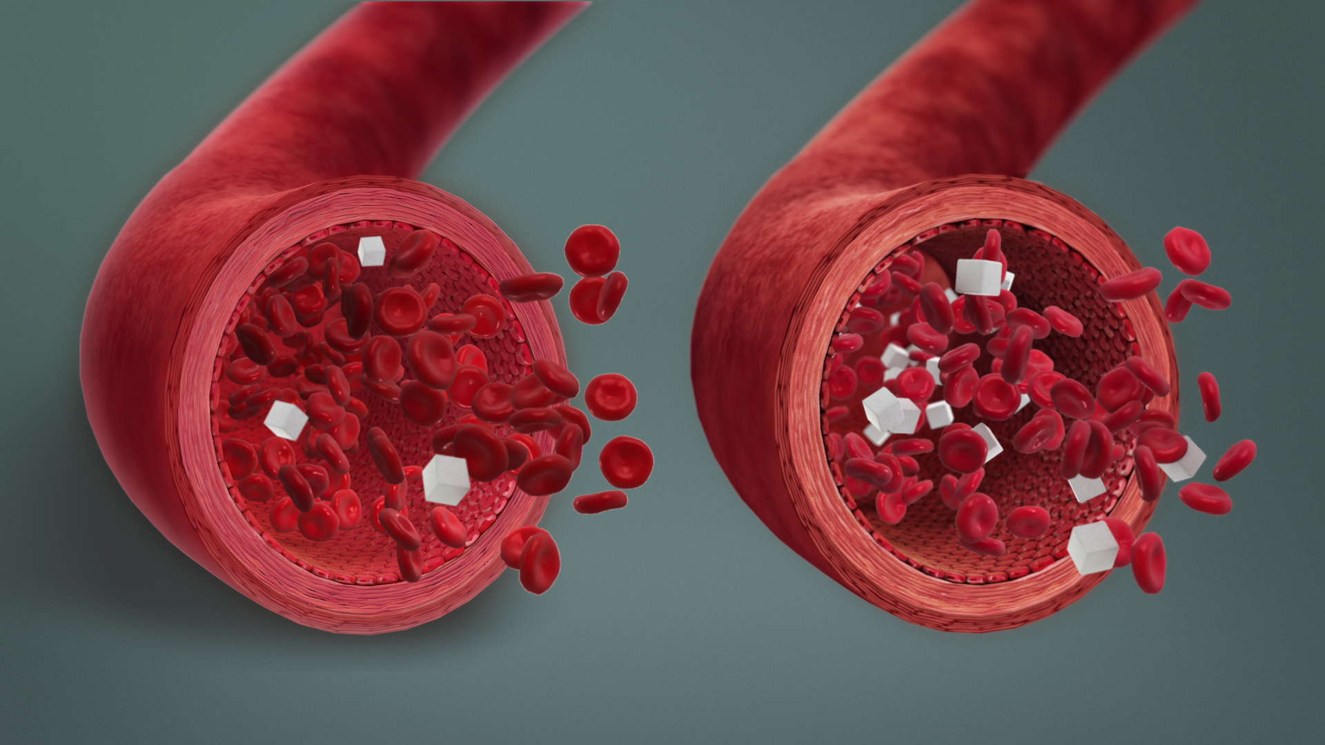 hypoglycemia in blood stream