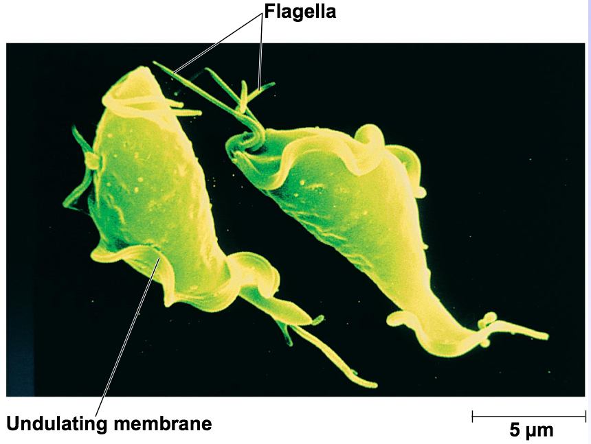 Trichomonas vaginalis close up