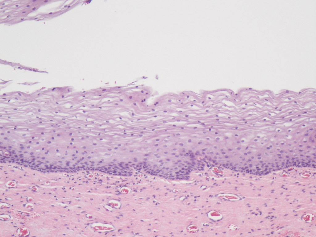 vaginal mucosa