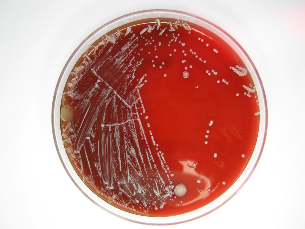 propionibacterium acnes bacteria 