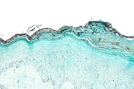 dermatomycoses under the microscope