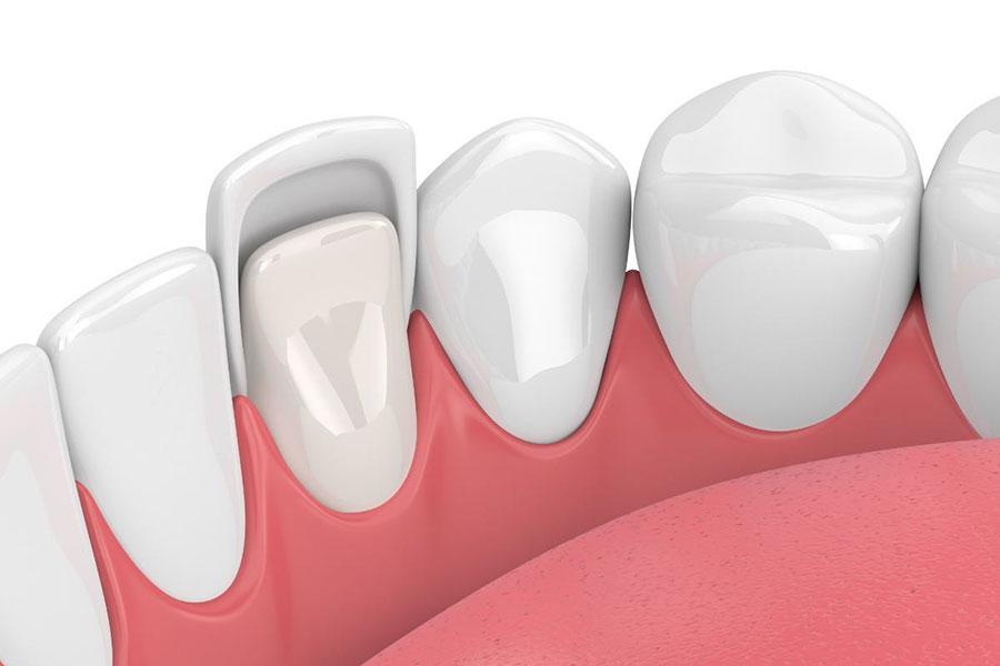 enamel and teeth
