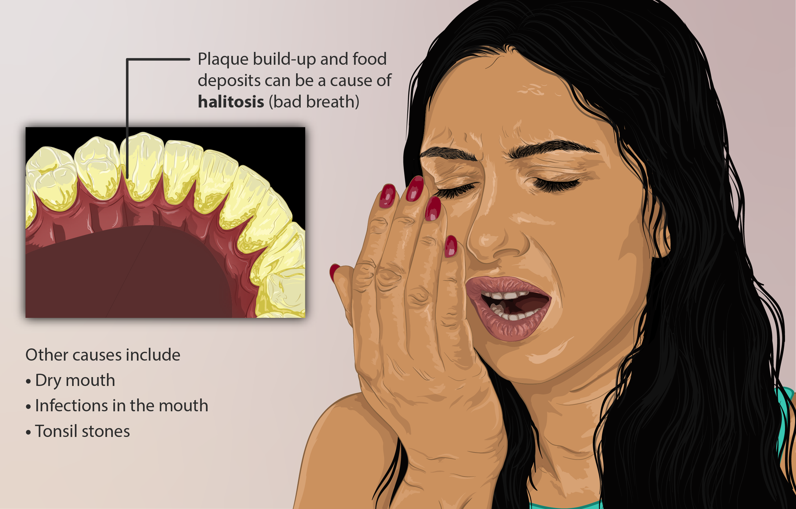 halitosis and it's symptoms