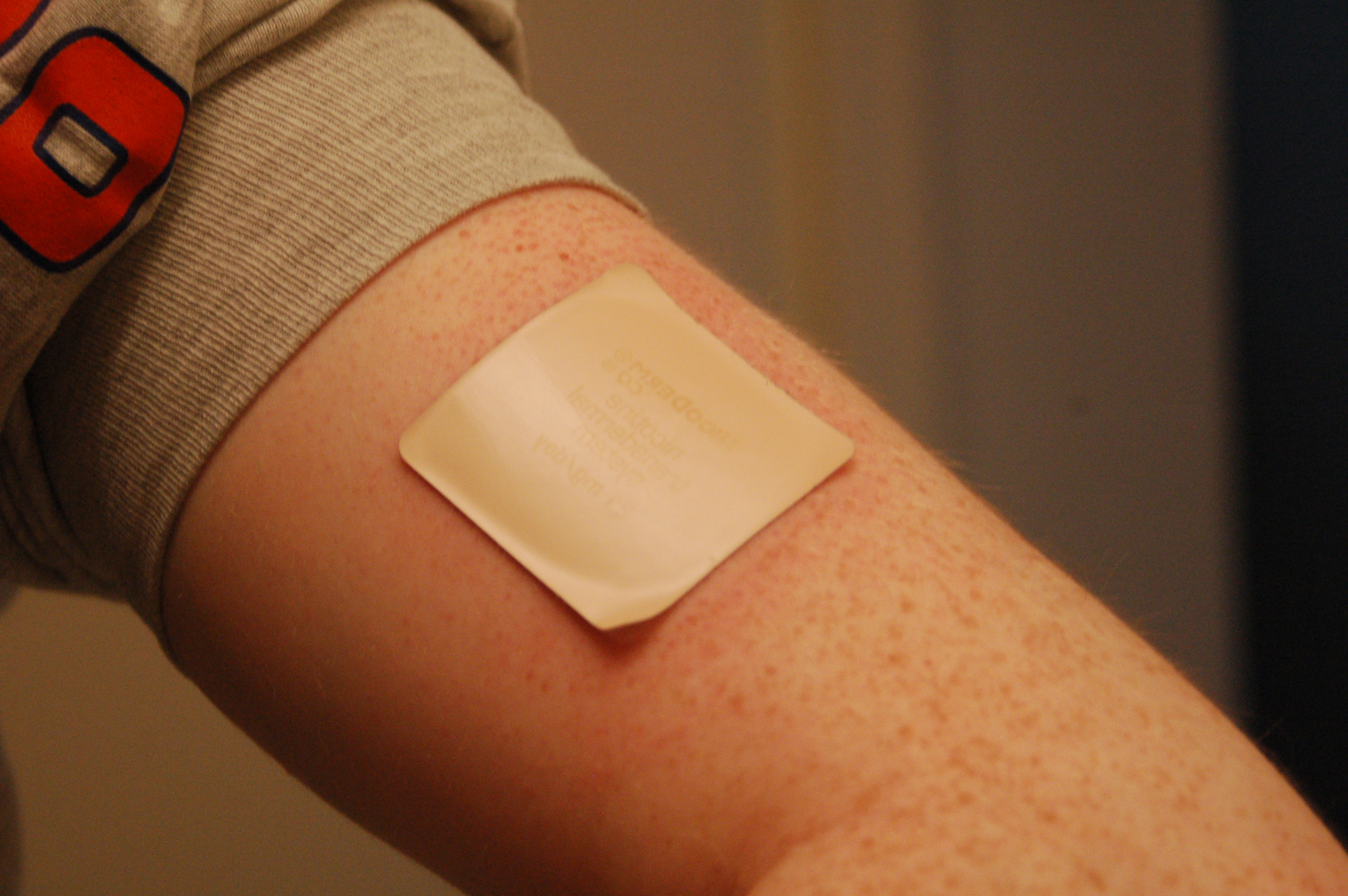 medicine patch on arm
