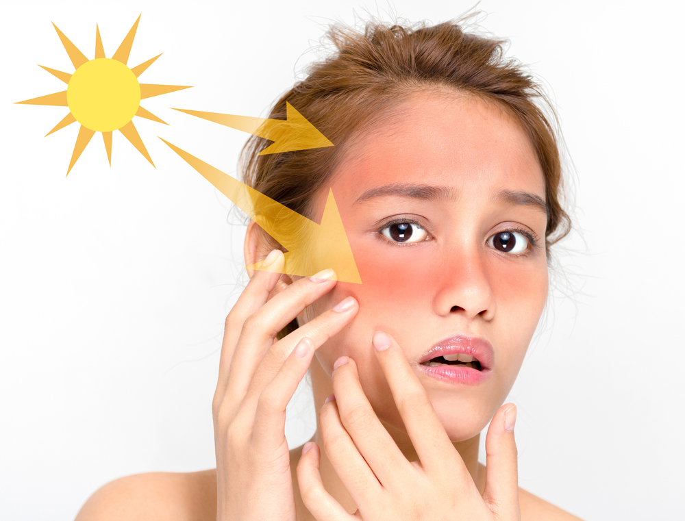 Person with sun burn