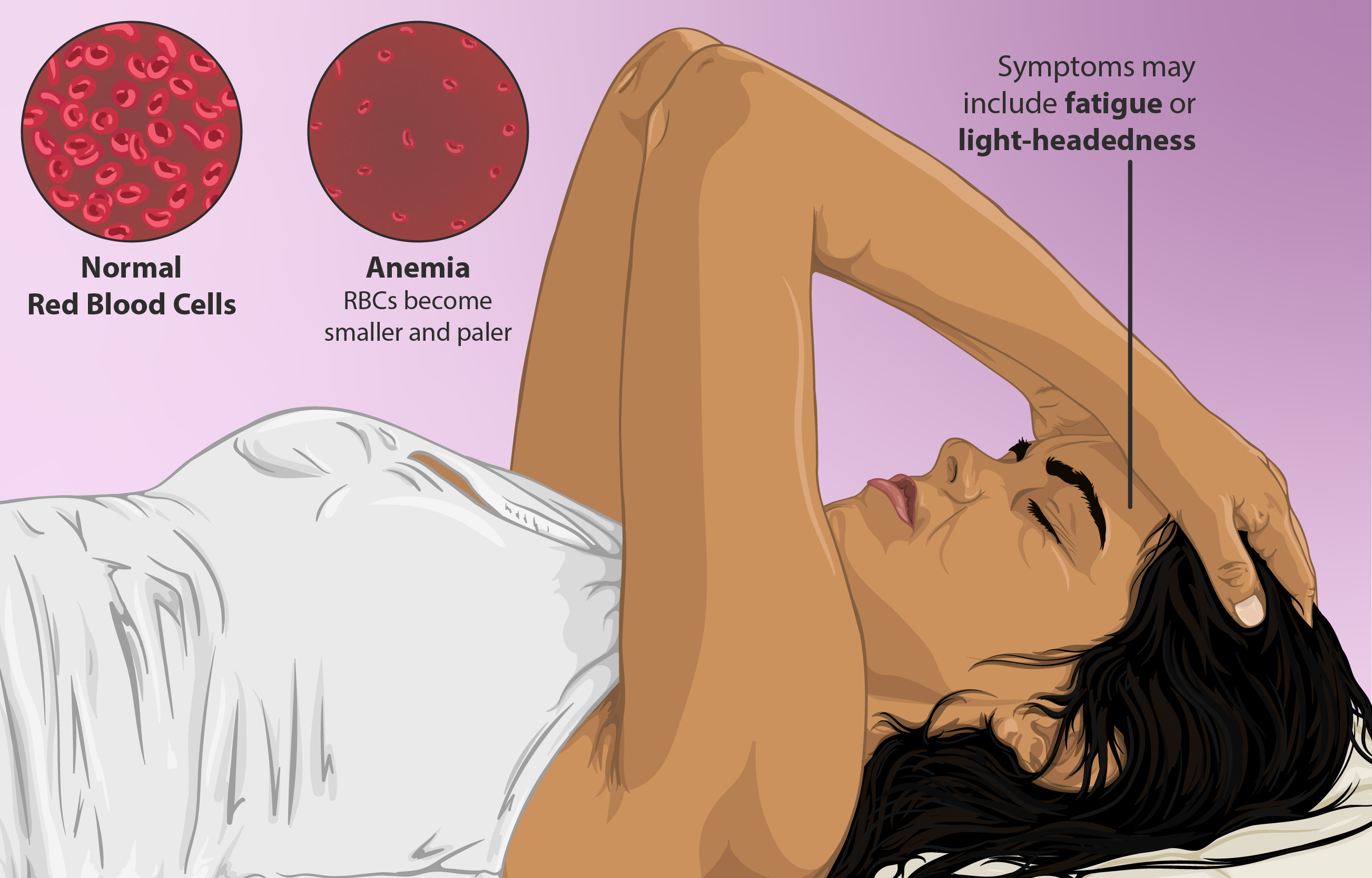 woman suffering with anemia